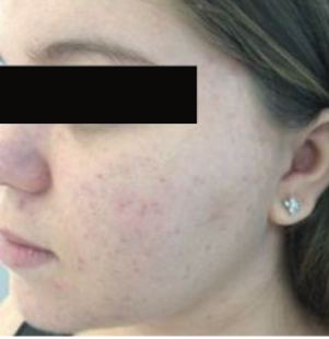 Lumiere Skin Clinic | Manchester