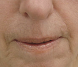Lumiere Skin Clinic | Manchester