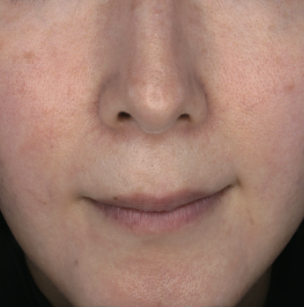 Lumiere Skin Clinic | Manchester