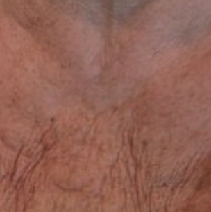 Lumiere Skin Clinic | Manchester