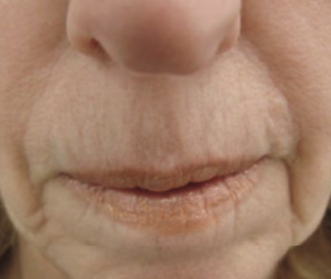 Lumiere Skin Clinic | Manchester
