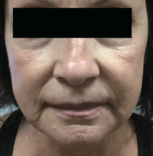 Lumiere Skin Clinic | Manchester