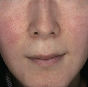 Lumiere Skin Clinic | Manchester