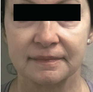 Lumiere Skin Clinic | Manchester