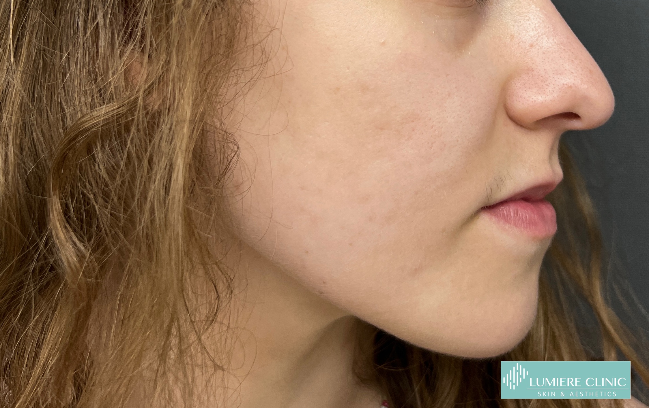 Lumiere Skin Clinic | Manchester