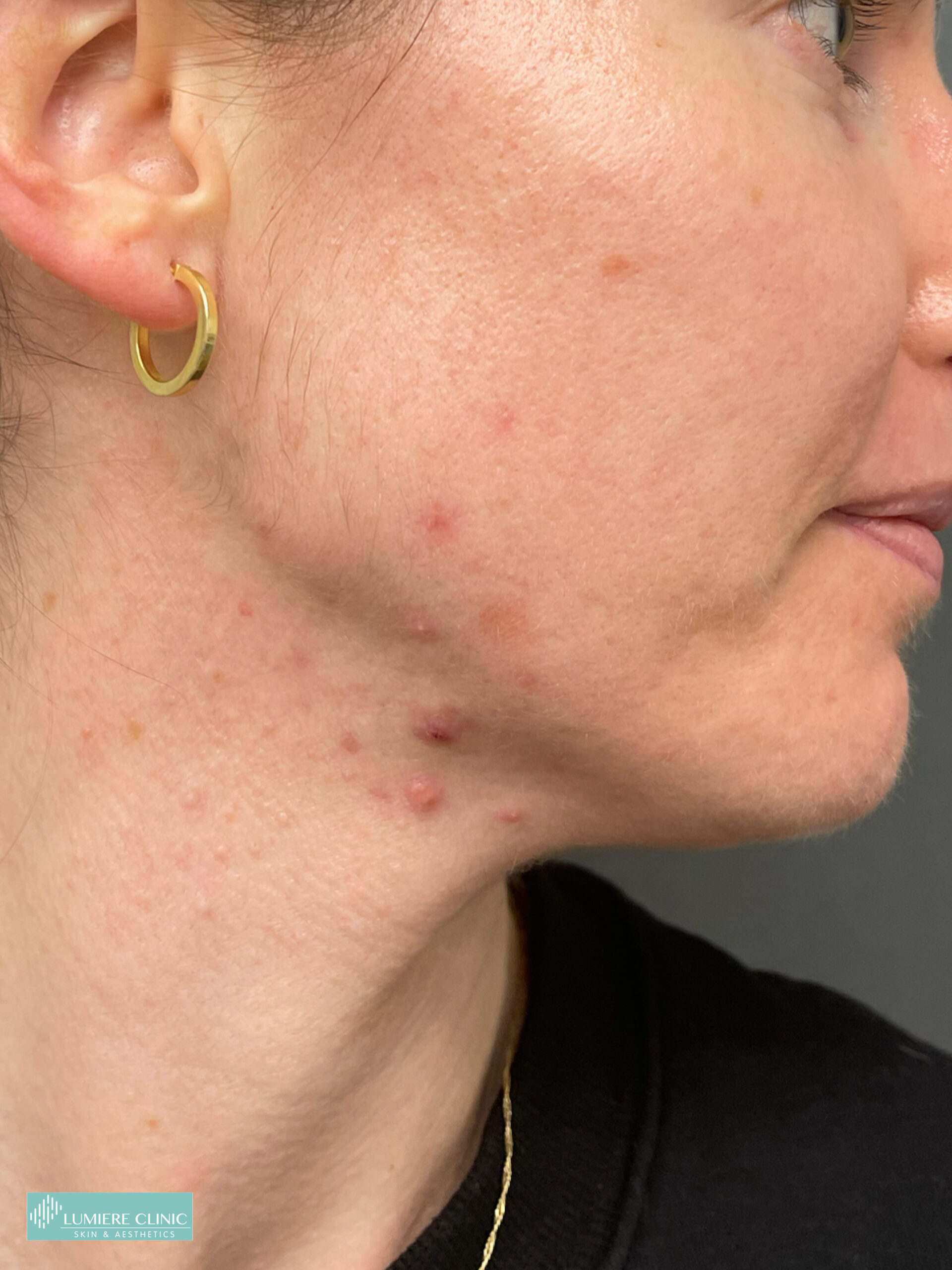 Lumiere Skin Clinic | Manchester