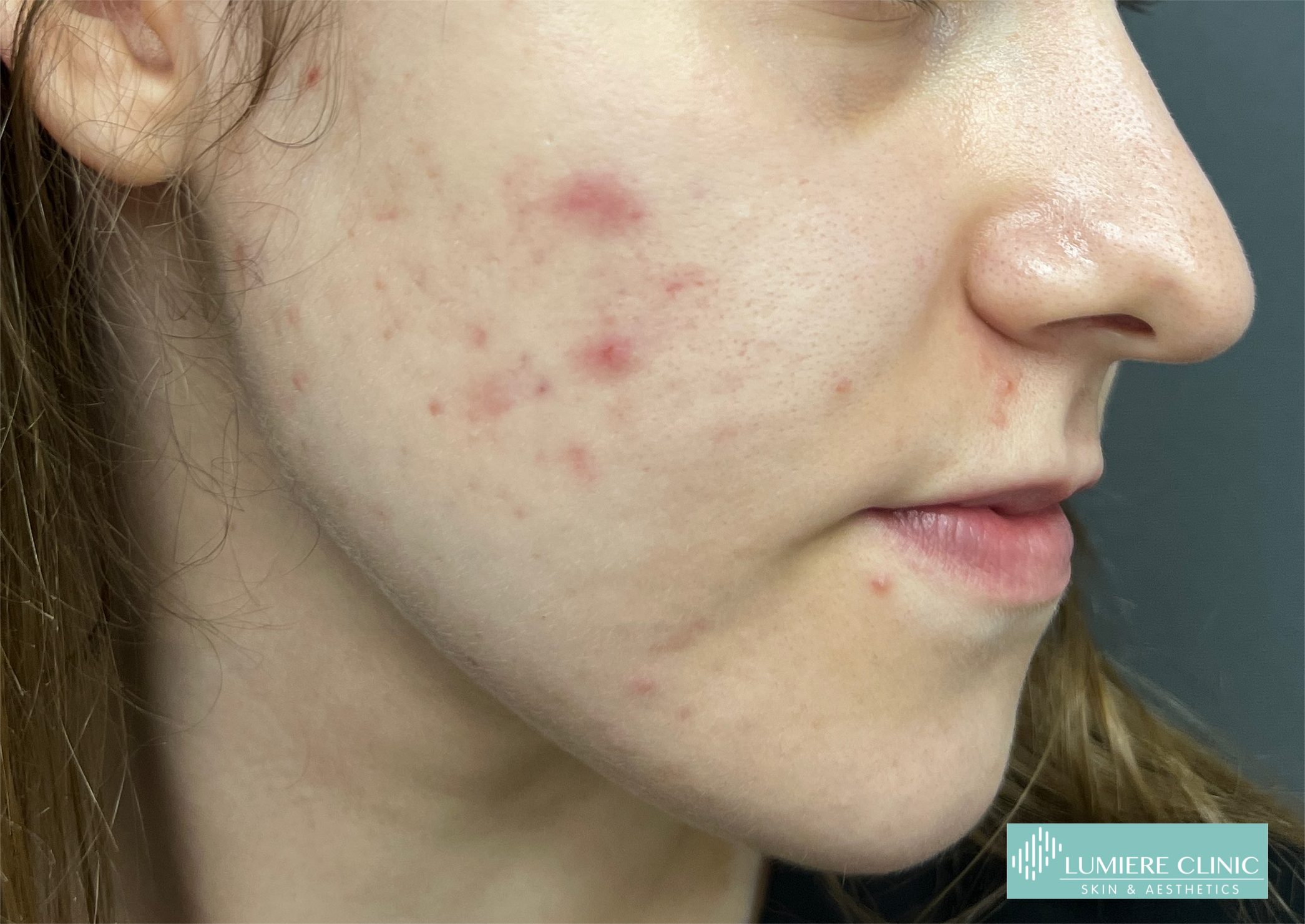 Lumiere Skin Clinic | Manchester