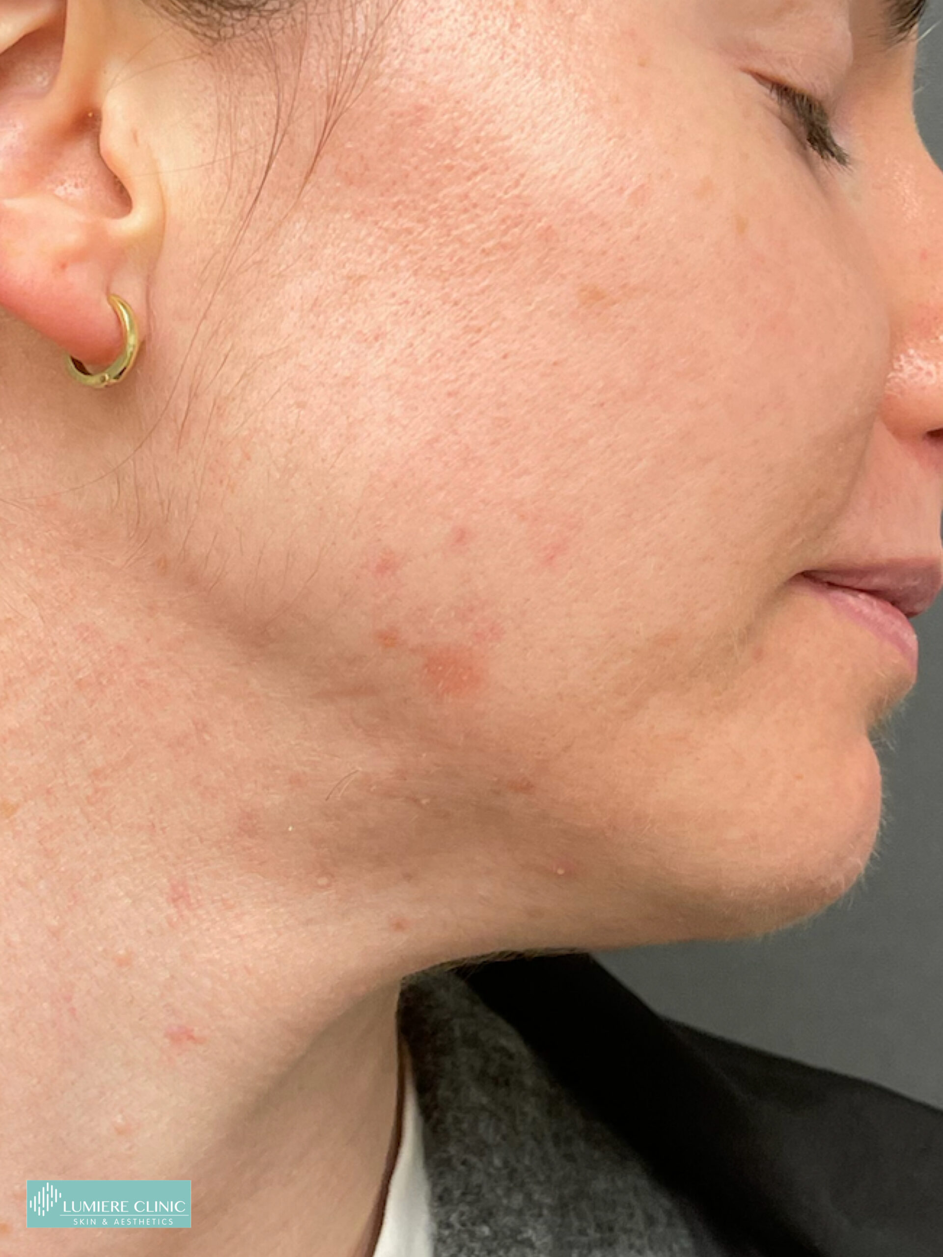 Lumiere Skin Clinic | Manchester